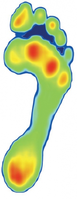 Gait Analysis for Sports and Fitness